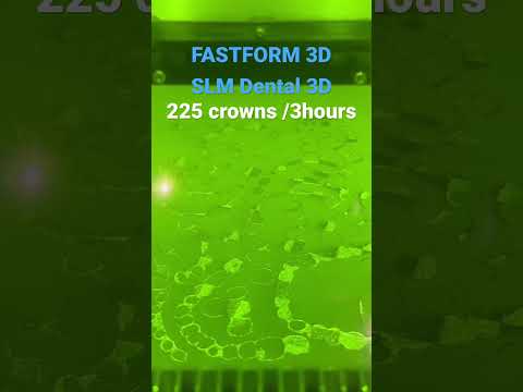 Видео печати зубных коронок на 3D-принтере FastForm