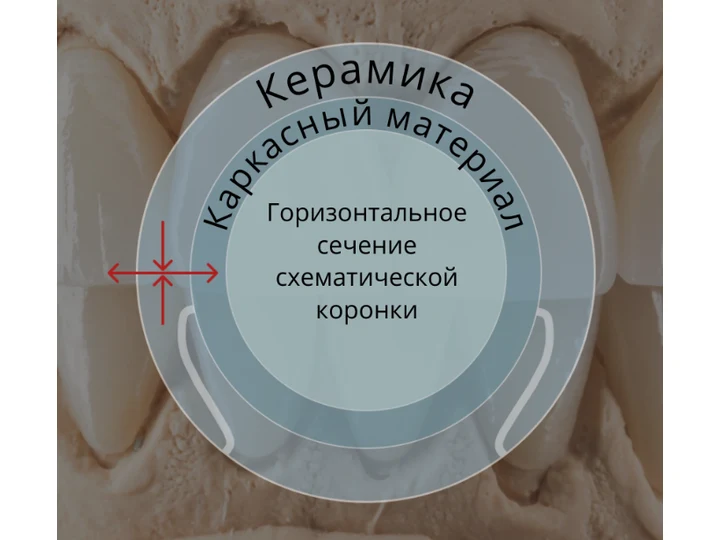 Схема сечения коронки с направлениями напряжений в облицовке