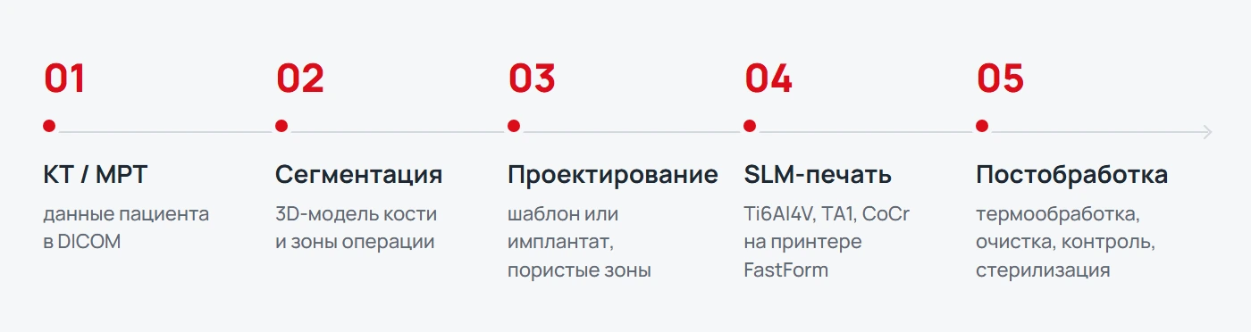 Схема: КТ или МРТ, сегментация, проектирование, SLM-печать, постобработка